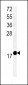 TM222 Antibody (Center)